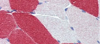 Anti-MYL6 antibody, Internal used in IHC (Paraffin sections) (IHC-P). GTX44875