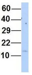 Anti-MYL6 antibody, N-term used in Western Blot (WB). GTX44876