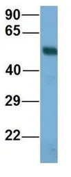 Anti-BBS4 antibody, N-term used in Western Blot (WB). GTX44878