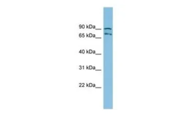 Anti-MTRR antibody, N-term used in Western Blot (WB). GTX44879