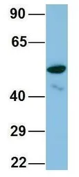 Anti-TINAGL1 antibody, Internal used in Western Blot (WB). GTX44884