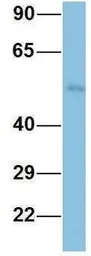 Anti-TINAGL1 antibody, Internal used in Western Blot (WB). GTX44884