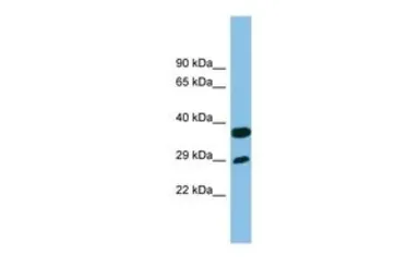 Anti-RTP4 antibody, Internal used in Western Blot (WB). GTX44887