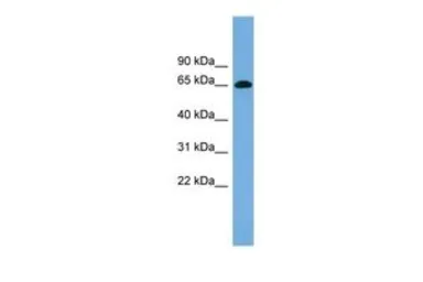 Anti-VIPAR antibody, Internal used in Western Blot (WB). GTX44894