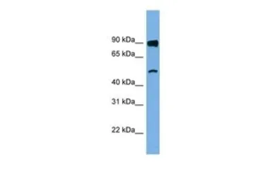 Anti-FAM160B1 antibody, N-term used in Western Blot (WB). GTX44901
