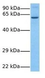 Anti-TBC1D24 antibody, Internal used in Western Blot (WB). GTX44910