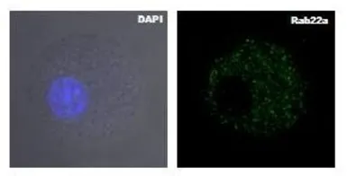 Anti-RAB22A antibody, Internal used in Immunocytochemistry/ Immunofluorescence (ICC/IF). GTX44911