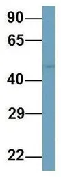 Anti-Pellino1 antibody, N-term used in Western Blot (WB). GTX44912