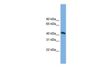 Anti-ANKMY2 antibody, N-term used in Western Blot (WB). GTX44920