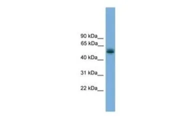 Anti-CCDC76 antibody, N-term used in Western Blot (WB). GTX44927