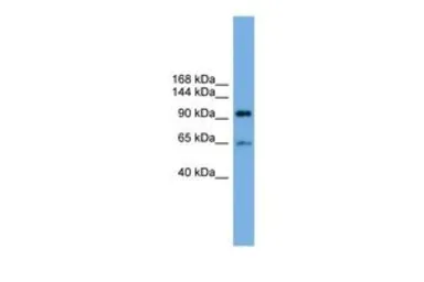 Anti-EXOC6 antibody, Internal used in Western Blot (WB). GTX44928