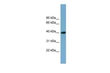 Anti-CXORF9 antibody, N-term used in Western Blot (WB). GTX44930