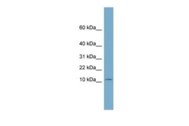 Anti-NOP10 antibody, Internal used in Western Blot (WB). GTX44934