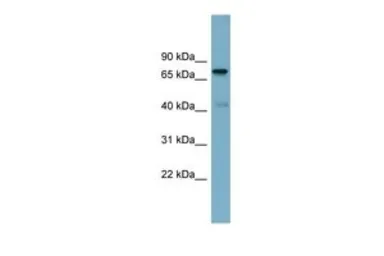 Anti-LRDD antibody, N-term used in Western Blot (WB). GTX44938