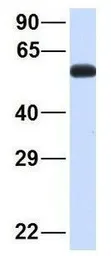 Anti-SPATA7 antibody, Internal used in Western Blot (WB). GTX44945