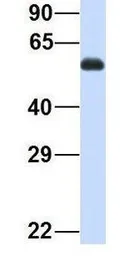 Anti-SPATA7 antibody, Internal used in Western Blot (WB). GTX44945