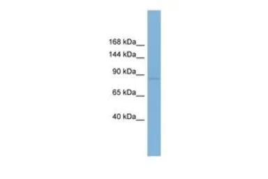 Anti-RSBN1 antibody, N-term used in Western Blot (WB). GTX44947