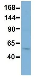 Anti-RSBN1 antibody, N-term used in Western Blot (WB). GTX44947