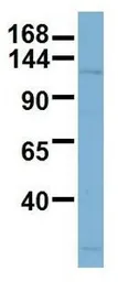 Anti-TTC17 antibody, N-term used in Western Blot (WB). GTX44957