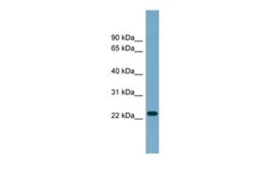 Anti-ARL8B antibody, Internal used in Western Blot (WB). GTX44967
