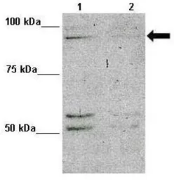 Anti-MAP7D1 antibody, N-term used in Western Blot (WB). GTX44977
