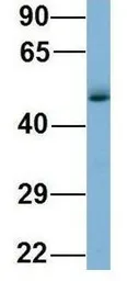 Anti-WIPI1 antibody, Internal used in Western Blot (WB). GTX44982