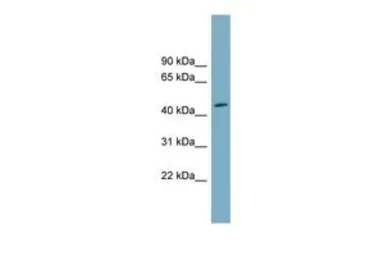 Anti-FAM53C antibody, N-term used in Western Blot (WB). GTX44999