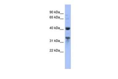 Anti-MRPL37 antibody, N-term used in Western Blot (WB). GTX45001