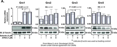 Anti-GLRX5 antibody, Internal used in Western Blot (WB). GTX45005