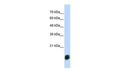 Anti-GLRX5 antibody, Internal used in Western Blot (WB). GTX45005