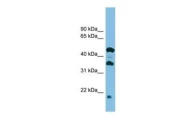 Anti-C11orf73 antibody, Internal used in Western Blot (WB). GTX45007