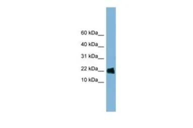 Anti-GOLGA7 antibody, Internal used in Western Blot (WB). GTX45019