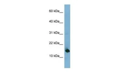 Anti-MED31 antibody, N-term used in Western Blot (WB). GTX45020