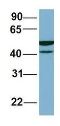 Anti-C22ORF28 antibody, Internal used in Western Blot (WB). GTX45034
