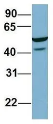 Anti-C22ORF28 antibody, Internal used in Western Blot (WB). GTX45034