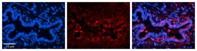 Anti-C22ORF28 antibody, N-term used in IHC (Paraffin sections) (IHC-P). GTX45035