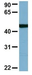 Anti-C22ORF28 antibody, N-term used in Western Blot (WB). GTX45035