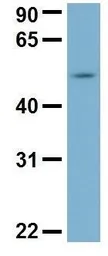 Anti-C22ORF28 antibody, N-term used in Western Blot (WB). GTX45035