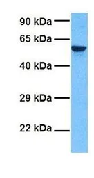 Anti-C22ORF28 antibody, N-term used in Western Blot (WB). GTX45035