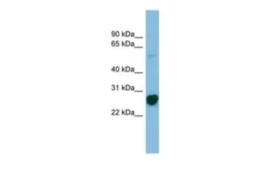 Anti-RPL10A antibody, N-term used in Western Blot (WB). GTX45038