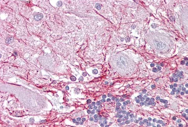 Anti-RP2 antibody, Internal used in IHC (Paraffin sections) (IHC-P). GTX45039