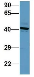 Anti-SERPINE2 antibody, Internal used in Western Blot (WB). GTX45043