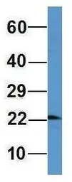 Anti-OMP antibody, Internal used in Western Blot (WB). GTX45044