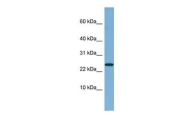 Anti-NBL1 antibody, Internal used in Western Blot (WB). GTX45046