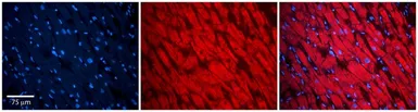Anti-PKP2 antibody, N-term used in IHC (Paraffin sections) (IHC-P). GTX45051