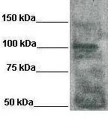 Anti-PKP2 antibody, N-term used in Western Blot (WB). GTX45051