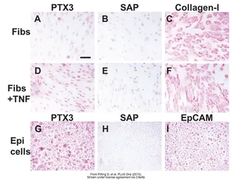 Anti-Pentraxin 3 antibody, N-term used in Immunocytochemistry/ Immunofluorescence (ICC/IF). GTX45054
