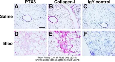 Anti-Pentraxin 3 antibody, N-term used in IHC (Frozen sections) (IHC-Fr). GTX45054