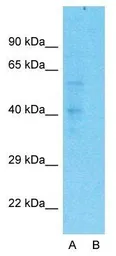 Anti-Pentraxin 3 antibody, N-term used in Western Blot (WB). GTX45054