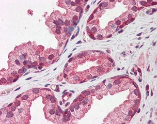 Anti-Pentraxin 3 antibody, N-term used in IHC (Paraffin sections) (IHC-P). GTX45054